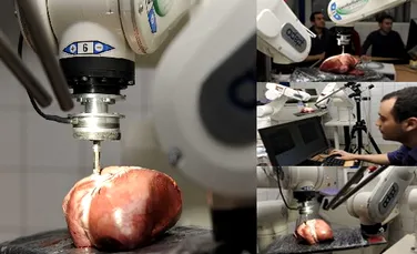 Robotul-chirurg opereaza direct pe inima