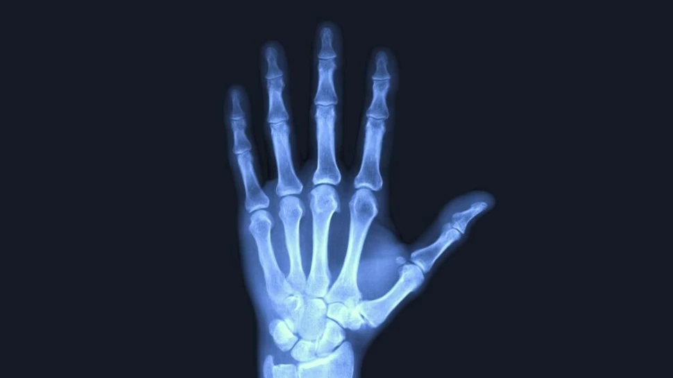 Test de cultură generală. Cine a descoperit razele X?