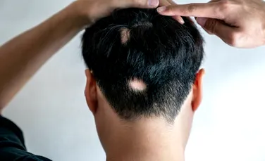 Noi cercetări arată că un îndulcitor ar putea ajuta la creșterea părului