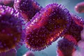 Focare și decese cauzate de variola maimuței în toată lumea