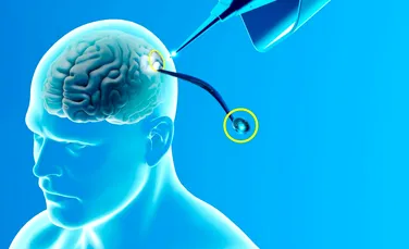 Cofondatorul Neuralink plănuiește crearea unui tratament pentru orbire, bazat pe realitatea virtuală și augmentată