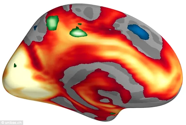 Activitatea creierul în timpul vizionării unor imagini emoţionale, cu conşinut negativ. Zonele roşii şi galbene indica regiunile mai active, iar verdele regiunile active doar la femei


