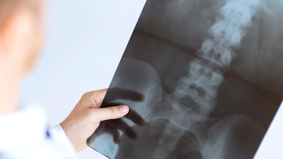 O femeie simţea ceva bizar în picioarele sale, iar doctorii au fost intrigaţi de ce au găsit în coloana acesteia