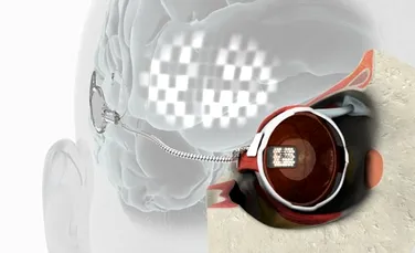 Cercetătorii australieni au reuşit în premieră implantul unui ochi bionic (VIDEO)