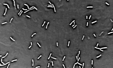 Cercetătorii ruşi anunţă descoperirea „bacilului nemuririi”!