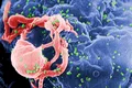 Cel mai vechi genom aproape complet al HIV a fost descoperit într-o mostră de țesut uitată din 1966