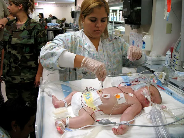 Un nou-născut conectat la un aparat ECO, care oxigenează artificial sângele, în timp ce inima micuţului nu funcţionează
