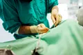 Un cuțit chirurgical care „miroase tumorile” poate detecta cancerul uterin în doar câteva secunde