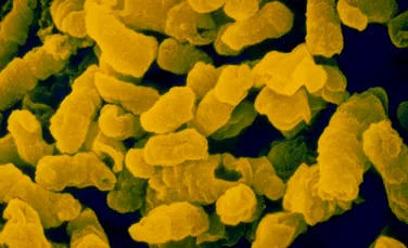 O bacterie mortală infectează copiii de peste 1.400 de ani