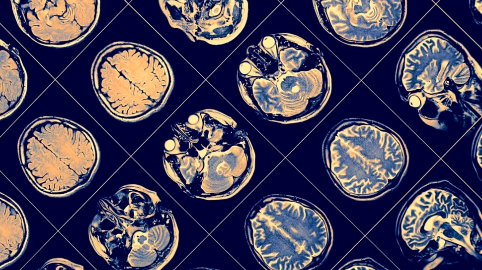 Un nou studiu schimbă tot ce știam despre modul în care funcționează memoria