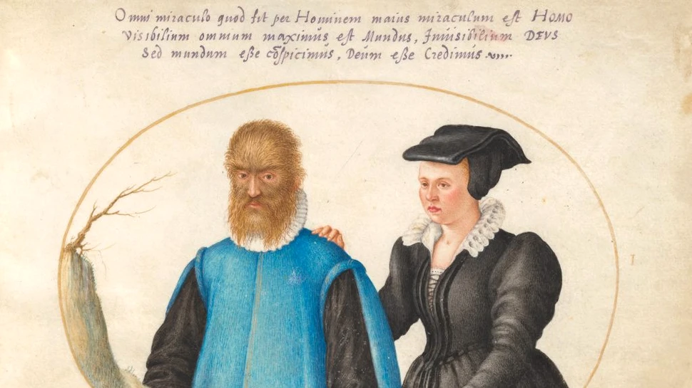 Ştiaţi că omul pădurilor chiar a existat? Petrus Gonsalvus s-a născut în 1537, în Tenerife, şi avea tot corpul acoperit de păr. A fost inspiraţia pentru Frumoasa şi Bestia