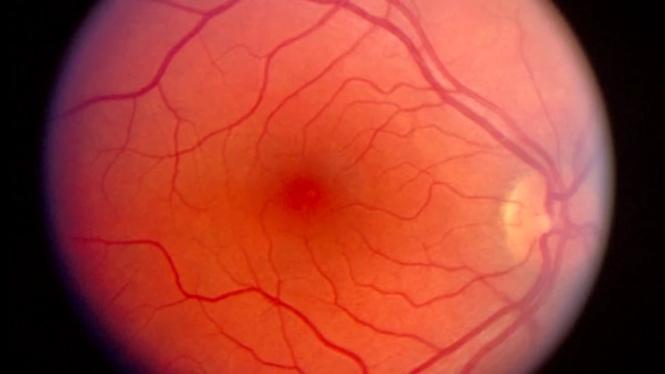 O retina artificiala din celule stem embrionale