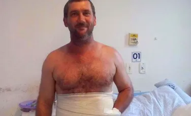 Un chirurg brazilian a salvat mâna unui bărbat prin coaserea ei în ABDOMEN. ”Nu am putut să cred când mi-au spus” – FOTO+VIDEO