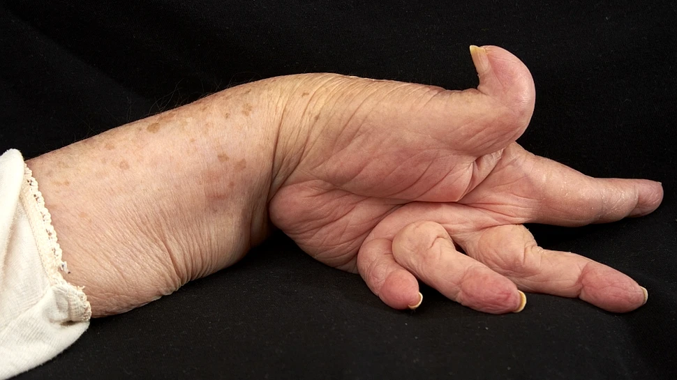 „E o descoperire izbitoare”: oamenii de ştiinţă au identificat un factor neaşteptat legat de apariţia unei boli misterioase