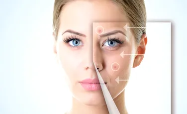 Ştiinţa din spatele acneii: de ce nu ar trebui să storci coşurile? FOTO+VIDEO