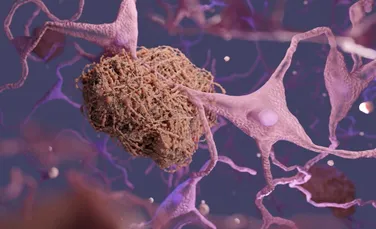 Cum încearcă oamenii de știință să ajute creierul să elimine boala Alzheimer în mod natural