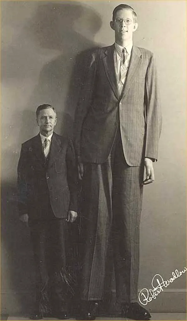 Cea mai înaltă persoană din istorie, Robert Wadlow, suferea de acromegalie, atingând 2,72 metri înălţime în momentul morţii.