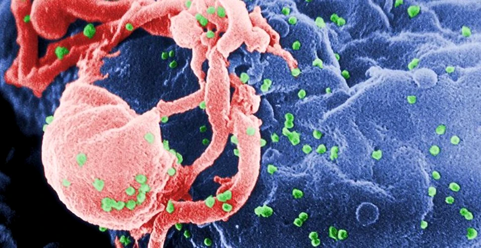 O boală enigmatică, ce aminteşte de SIDA, produce confuzie printre medici