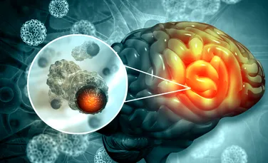 Un nou dispozitiv detectează tumorile cerebrale cu ajutorul urinei