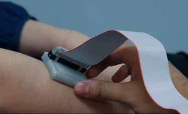 VIDEO. Invenţia unei tinere echipe care le-a adus un premiu prestigios: un detector de cancer de piele ieftin şi portabil care poate salva numeroase vieţi
