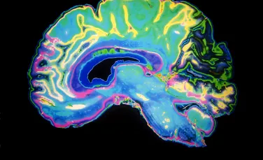A fost dezvoltat un test de sânge care detectează Alzheimer, dar și progresul bolii