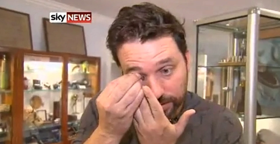 Un bărbat şi-a înlocuit ochiul pierdut cu o cameră video wireless (VIDEO)