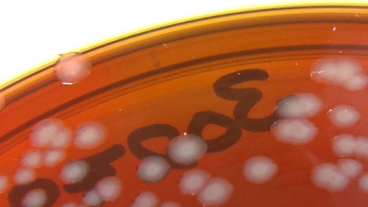 1-gonorrhoea-web-1024 