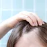 Un medicament comun pentru artrită ar putea stimula regenerarea părului la pacienții cu alopecie