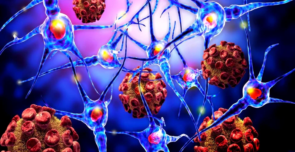 Boala Alzheimer poate proveni din altă parte a corpului şi nu din creier, conform unui rezultat surprinzător