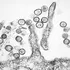 Focar mortal de hantavirus pe un vas de croazieră din Atlantic