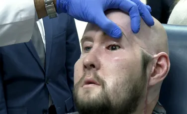 A fost realizat primul transplant de ochi din lume! „Reprezintă un moment revoluționar”