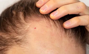 Un studiu arată modul surprinzător în care crește părul