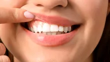 Un medicament inovator pentru regenerarea dinților, testat în premieră pe oameni