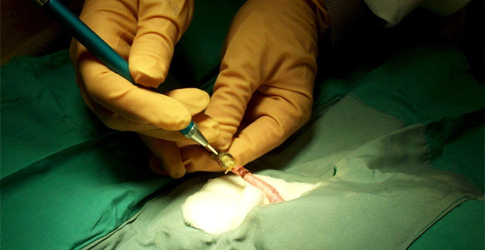 Nanochirurgie laser: operatii cu cicatrici de numai 0,0003 mm