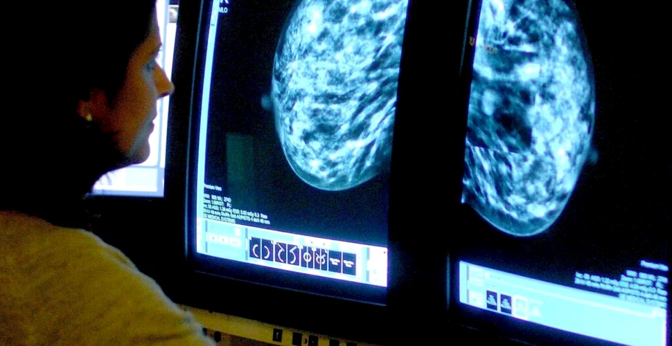 Zeci de mii de femei din Anglia ar putea primi un medicament pentru prevenirea cancerului de sân