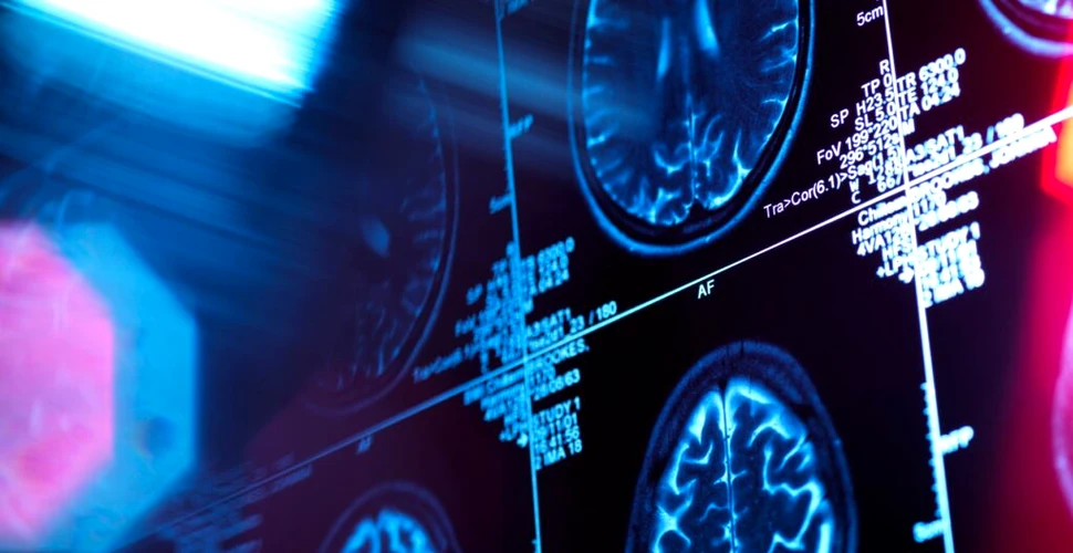 Un studiu pune la îndoială tot ce credeam că știm despre Alzheimer. Care ar fi de fapt cauza bolii?