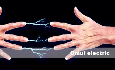 Omul electric