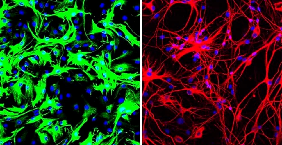 Un tratament simplu a generat noi neuroni și a eliminat maladia Parkinson la șoareci