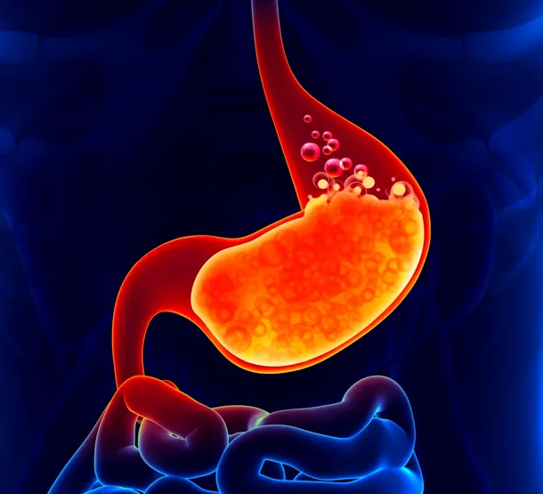 Sfincterul esofagian, care previne trecerea conţinutului alimentar din stomac în esofag, devine mai slab odată cu înaintarea în vârstă