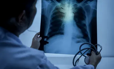 O boală antică revine în forță! Nici cele mai avansate antibiotice nu-i fac față