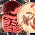 Bolile care nu vor să dispară, în ciuda progreselor din medicină