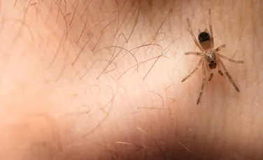 Un bărbat susţine că un păianjen a supravieţuit timp de 3 zile în corpul său, târându-se pe sub piele (FOTO)