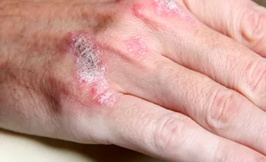 Aparatul care „vede sub piele” îi va ajuta pe medici să diagnosticheze diferite boli, inclusiv cancere