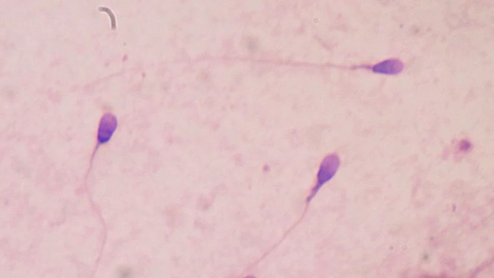 O descoperire genetică poate duce la producerea primului anticoncepţional masculin
