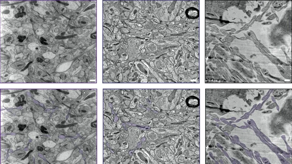 Neuronii nu arată așa cum credeam, dezvăluie un studiu controversat