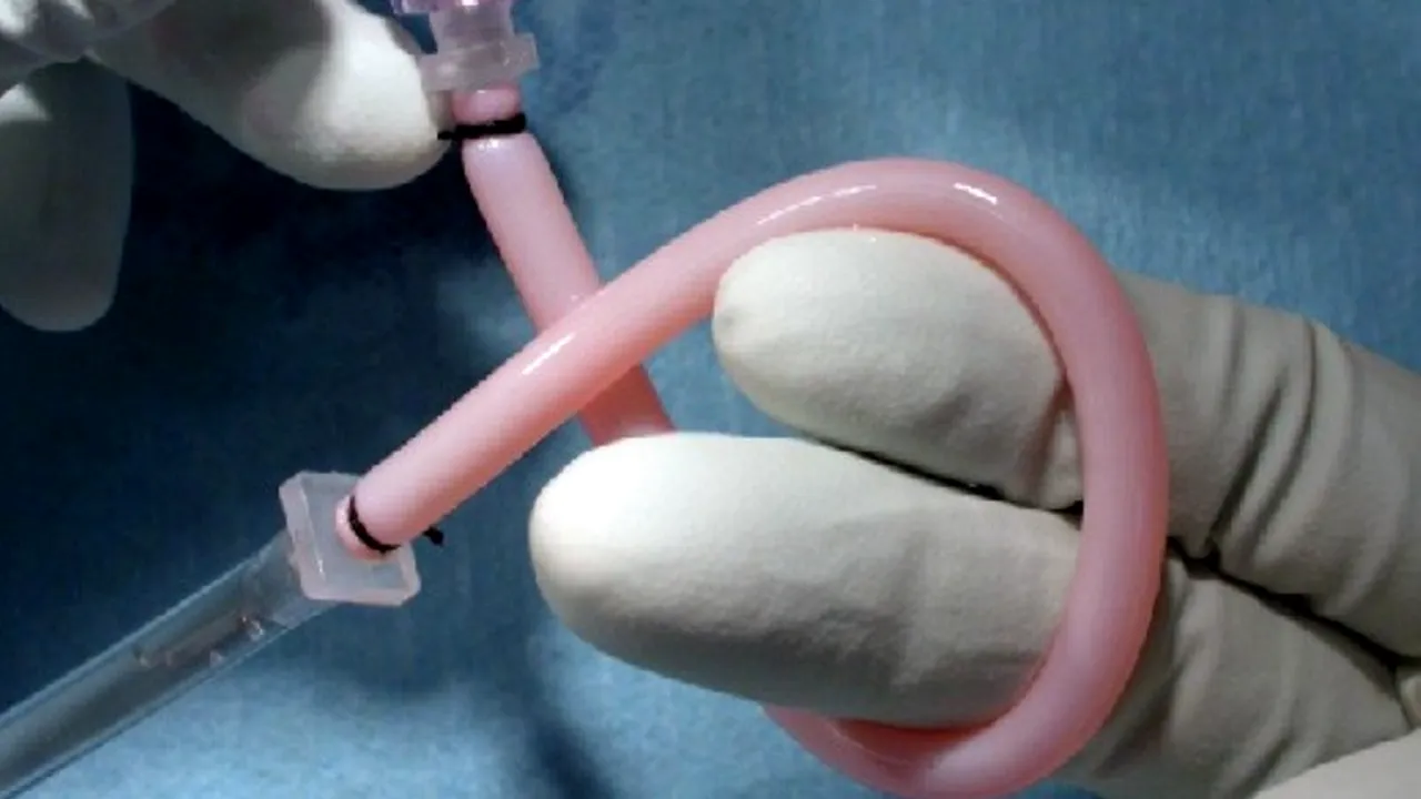 1-vas-sintetic 