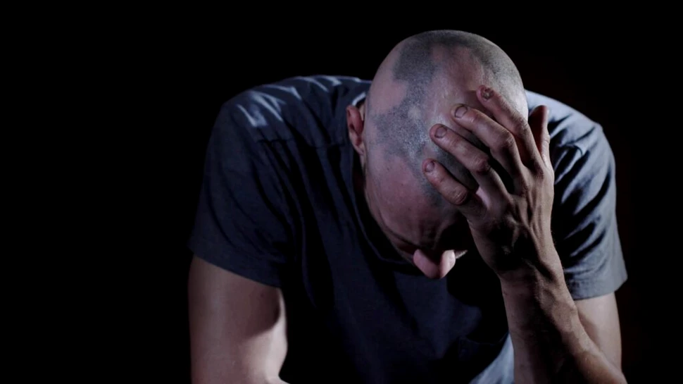 Alopecia severă (căderea părului) ar putea fi tratată cu un medicament comun pentru artrită