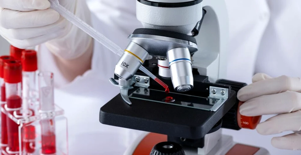 Cercetătorii au folosit ultrasunete focalizate pentru a micșora tumorile de prostată fără intervenție chirurgicală