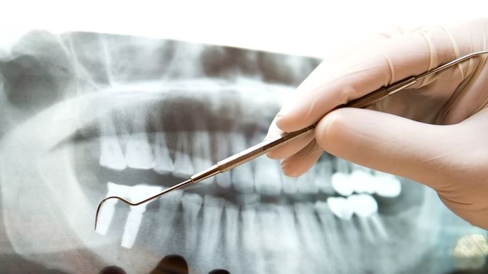 Copilul tău are nevoie de aparat dentar? Iată la ce semne ar trebui să fii atent