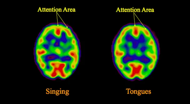 Creierul unui medium în timp ce cântă sau vorbeşte în limbi străine, în timpul transei